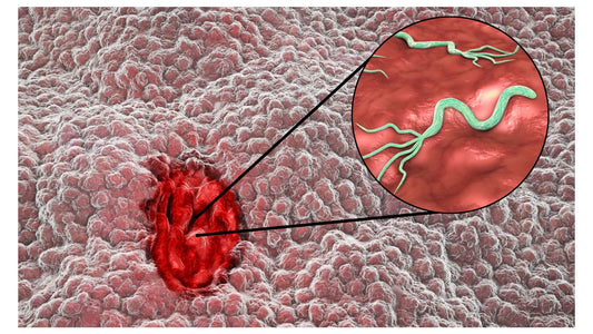 Helicobacter pylori – Bacteria ascunsă care îți atacă stomacul